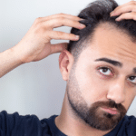 Image of a man looking worried while examining his hair.